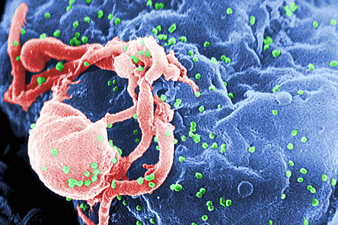 FOTO – Governo estuda novas formas de prevenir o contágio pelo vírus HIV.slafee.files.wordpress.com