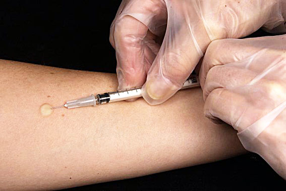 Novo teste pode estimar idade pelo sangue. clinicalcorrelations.org