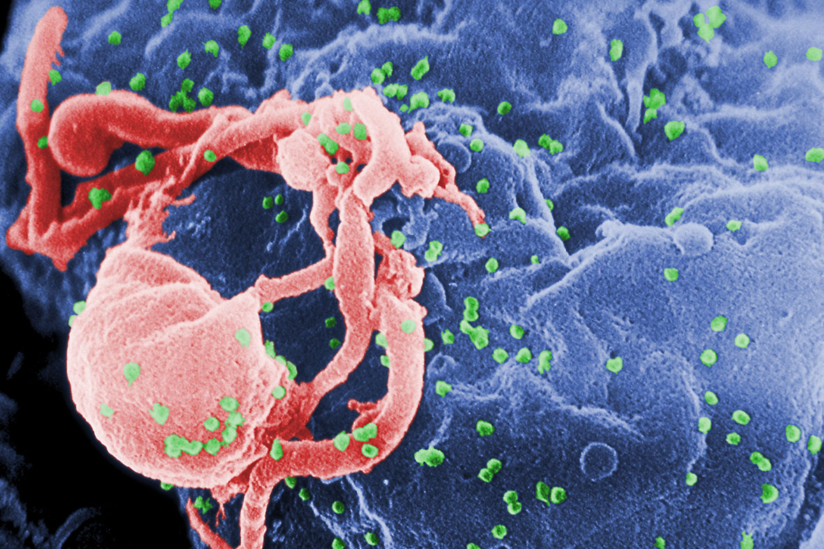 HIV pára de se replicar com terapia antirretroviral. Foto: wikimedia.org